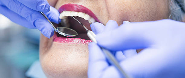 Best Emergency Treatment for Dental Infections or Abscesses in Carrollton, OH